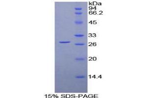 SDS-PAGE analysis of Human LILRA2 Protein. (LILRA2 Protéine)