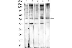Western blot analysis using KRT6A mouse mAb against Hela (1), MCF-7 (2), SW480 (3), HepG2 (4), and T47D (5) cell lysate.