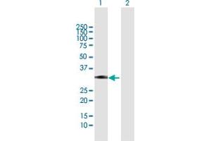 Western Blot analysis of ZCRB1 expression in transfected 293T cell line by ZCRB1 MaxPab polyclonal antibody.