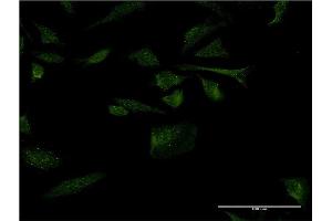 Immunofluorescence of monoclonal antibody to RANGRF on HeLa cell.