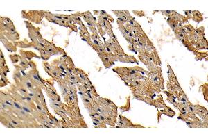 Detection of IRAK4 in Mouse Cardiac Muscle Tissue using Polyclonal Antibody to Interleukin 1 Receptor Associated Kinase 4 (IRAK4)