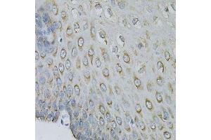 Immunohistochemistry of paraffin-embedded human esophagus using EIF4B Antibody. (EIF4B anticorps)