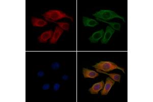ABIN6262495 and ABIN6277945 staining Hela cells by IF/ICC. (IGFBP2 anticorps  (C-Term))