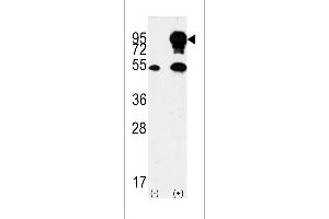 Western blot analysis of BRAF Antibody (Center) polyclonal antibody (ABIN392246 and ABIN2841936) (arrow). (SNRPE anticorps  (AA 424-453))