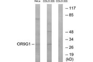 Western blot analysis of extracts from HeLa/COLO cells, using OR9G1 Antibody. (OR9G1 anticorps  (AA 158-207))