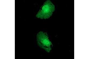 Anti-FKBPL mouse monoclonal antibody (ABIN2453045) immunofluorescent staining of COS7 cells transiently transfected by pCMV6-ENTRY FKBPL (RC202153). (FKBPL anticorps)
