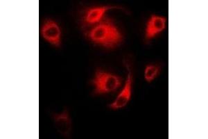 Immunofluorescent analysis of CD27 staining in MCF7 cells. (CD27 anticorps)