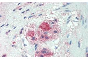 Detection of CSPG4 in Human Small Intestine Tissue using Monoclonal Antibody to Chondroitin Sulfate Proteoglycan 4 (CSPG4)