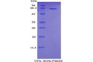 SDS-PAGE analysis of Human Sulfatase 2 Protein. (SULF2 Protéine)