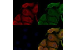 ABIN6258695 and ABIN6273499 staining Hela cells by IF/ICC. (TAB2 anticorps  (Internal Region))