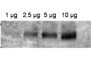 Western blot using  affinity purified anti-ABCB1 antibody shows detection of ABCB1 in crude membrane extracts from HF insect cells over-expressing human ABCB1. (ABCB1 anticorps  (Internal Region))