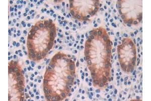 DAB staining on IHC-P; Samples: Human Stomach Tissue (ADH1 anticorps  (AA 169-370))