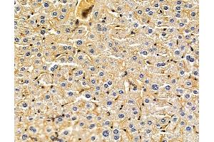ABIN7095956 and ABIN7100018 at 1/100 staining mouse liver tissue by IHC-P.