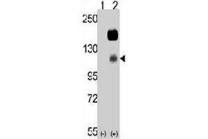 Western blot analysis of CCK4 (arrow) using rabbit PTK7 polyclonal antibody . (PTK7 anticorps  (N-Term))