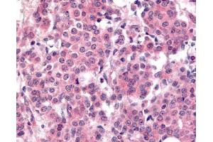 Immunohistochemistry. (PLK1 anticorps  (pThr210))