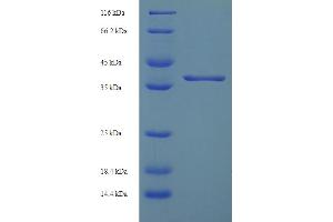 SDS-PAGE (SDS) image for Ankyrin Repeat and SOCS Box Containing 6 (ASB6) (AA 1-197), (full length) protein (His-SUMO Tag) (ABIN5711811)