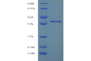 SDS-PAGE (SDS) image for Ankyrin Repeat and SOCS Box Containing 6 (ASB6) (AA 1-197), (full length) protein (His-SUMO Tag) (ABIN4975602) (ASB6 Protein (AA 1-197, full length) (His-SUMO Tag))