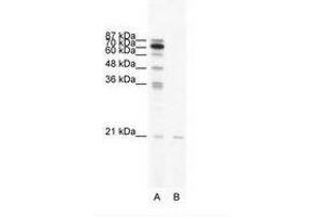 Image no. 1 for anti-SCAN Domain Containing 1 (SCAND1) (AA 65-114) antibody (ABIN6736033)