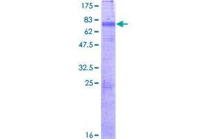 Image no. 1 for Small Conductance Calcium-Activated Potassium Channel Protein 3 (KCNN3) (AA 1-426) protein (GST tag) (ABIN1308473)