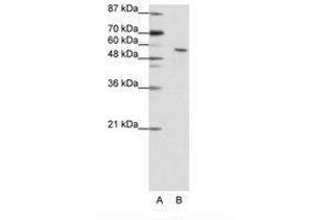 Image no. 1 for anti-Insulinoma-Associated 2 (INSM2) (N-Term) antibody (ABIN202769) (INSM2 anticorps  (N-Term))