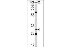 Western blot analysis of PITX1 antibody (Center) (ABIN391506 and ABIN2841469) in NCI- cell line lysates (35 μg/lane). (PITX1 anticorps  (AA 123-150))