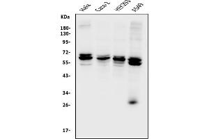 Western blot analysis of CDR2 using anti-CDR2 antibody (ABIN7599397). (CDR2 anticorps  (AA 1-441))