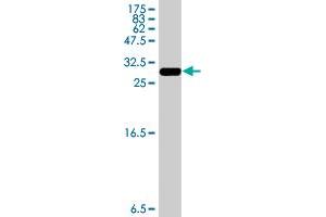 Western Blot detection against Immunogen (33.