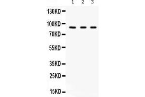 Western blot analysis of Factor B expression in A549 whole cell lysates ( Lane 1), 293T whole cell lysates ( Lane 2) and HELA whole cell lysates ( Lane 3).
