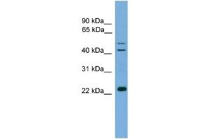 WB Suggested Anti-CHP  Antibody Titration: 0.