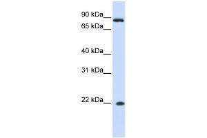 IFN Alpha 7 antibody used at 1 ug/ml to detect target protein.
