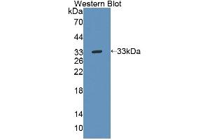 Figure. (Tec Protein Tyrosine Kinase (TEC) (AA 370-623) anticorps)