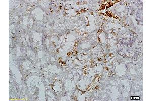 Formalin-fixed and paraffin embedded mouse kidney tissue labeled with  (ABIN736716)  Rabbit Anti-L-Selectin CD62L Polyclonal Antibody, unconjugated 1: 200 followed by incubation with conjugated secondary antibody and DAB staining