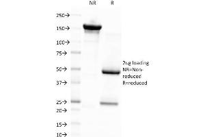anti-Epstein-Barr Virus Latent Membrane Protein 1 (EBV LMP1) antibody