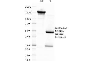 SDS-PAGE Analysis Purified EBV Mouse Monoclonal Antibody (CS4). (EBV LMP1 anticorps)