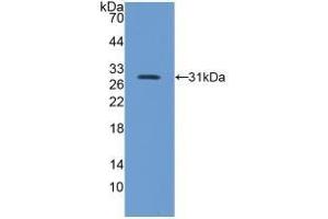Detection of Recombinant ITGb5, Mouse using Polyclonal Antibody to Integrin Beta 5 (ITGb5) (Integrin beta 5 anticorps  (AA 136-378))