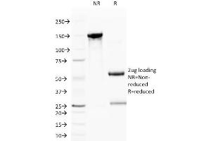 SDS-PAGE Analysis Purified CD59 Mouse Monoclonal Antibody (BRA-10G). (CD59 anticorps)
