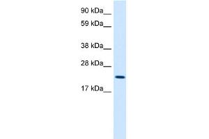 WB Suggested Anti-MYCL1 Antibody Titration:  2. (LMYC anticorps  (Middle Region))
