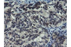 Image no. 1 for anti-Negative Regulator of Ubiquitin-Like Proteins 1 (NUB1) (AA 1-326) antibody (ABIN1490744)