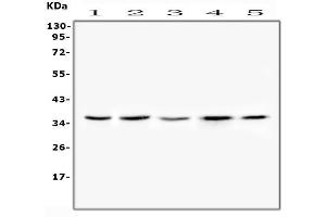 Western blot analysis of FRZB(SFRP3) using anti-FRZB(SFRP3) antibody (ABIN6719567).