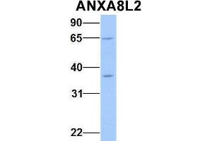 Host:  Rabbit  Target Name:  ANXA8L2  Sample Type:  Human Fetal Heart  Antibody Dilution:  1.