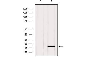 Western blot analysis of extracts from Rat muscle, using GMFG Antibody. (GMFG anticorps  (Internal Region))
