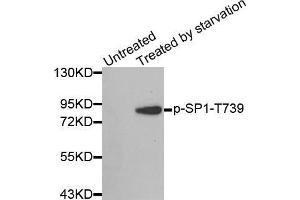 Western blot analysis of extracts from 3T3 cells, using Phospho-SP1-T739 antibody. (SP1 anticorps  (pThr739))