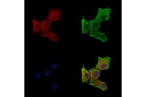 Phospho-EIF3J (Ser127) Antibody staining HepG2 cells(serum starvation treatment) by IF/ICC. (EIF3S1 anticorps  (pSer127))