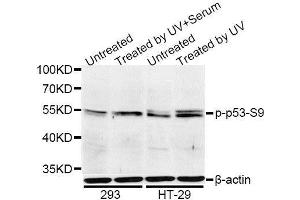 Western blot analysis of extracts of 293 and HT-29 cells, using Phospho-p53-S9 antibody.