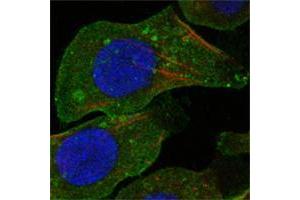 Confocal immunofluorescence analysis of A549 cells using DDR2 mouse mAb (green). (DDR2 anticorps)