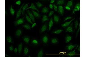 Immunofluorescence of monoclonal antibody to FH on HeLa cell.
