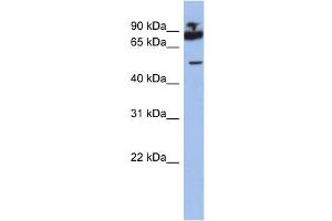 WB Suggested Anti-IKZF1 Antibody Titration:  0. (IKZF1 anticorps  (Middle Region))
