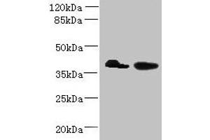 Western blot All lanes: L3HYPDH antibody at 8 μg/mL Lane 1: HepG2 whole cell lysate Lane 2: A549 whole cell lysate Secondary Goat polyclonal to rabbit IgG at 1/10000 dilution Predicted band size: 39 kDa Observed band size: 39 kDa (L3HYPDH anticorps  (AA 13-312))