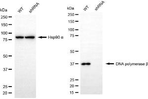 Western blotting analysis using DNA Polymerase beta antibody (ABIN7799875).