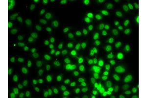 Immunofluorescence analysis of MCF-7 cells using SETD8 antibody (ABIN4905138). (SETD8 anticorps)